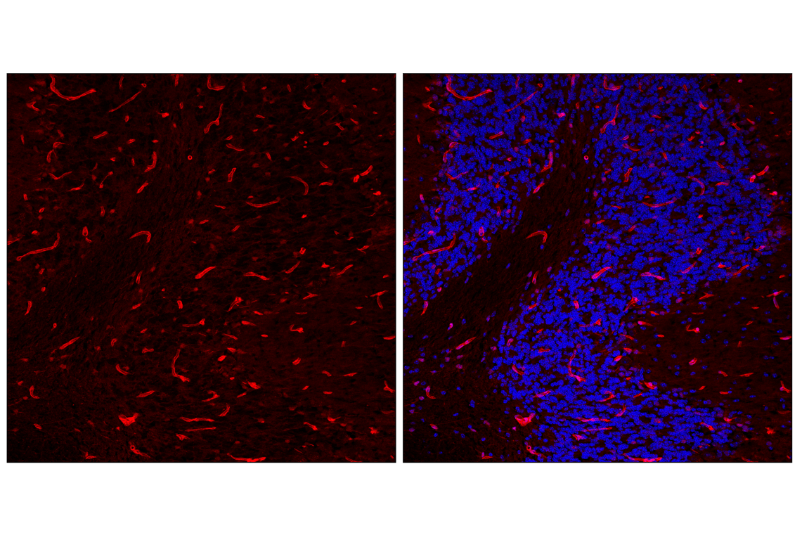 Immunofluorescence Image 1: YAP (D8H1X) Rabbit Monoclonal Antibody (Alexa Fluor<sup>®</sup> 647 Conjugate)