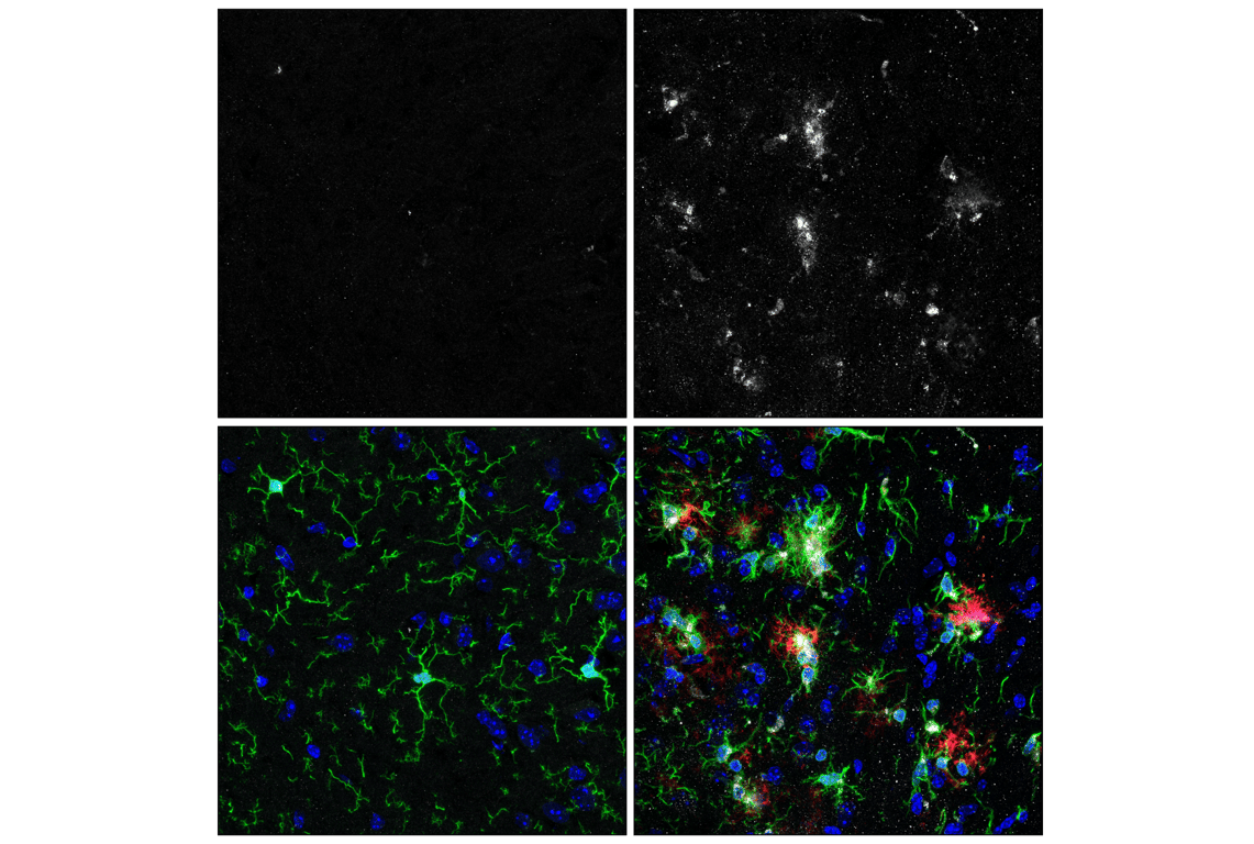 Immunofluorescence Image 1: TREM2 (E7O7Q) Rabbit Monoclonal Antibody