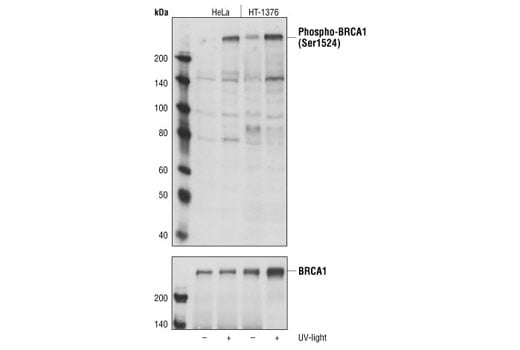 undefined Image 11: Double Strand Breaks (DSB) Repair Antibody Sampler Kit