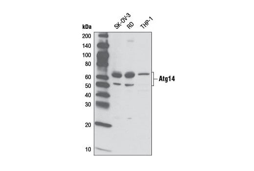 undefined Image 13: Autophagy Vesicle Nucleation Antibody Sampler Kit