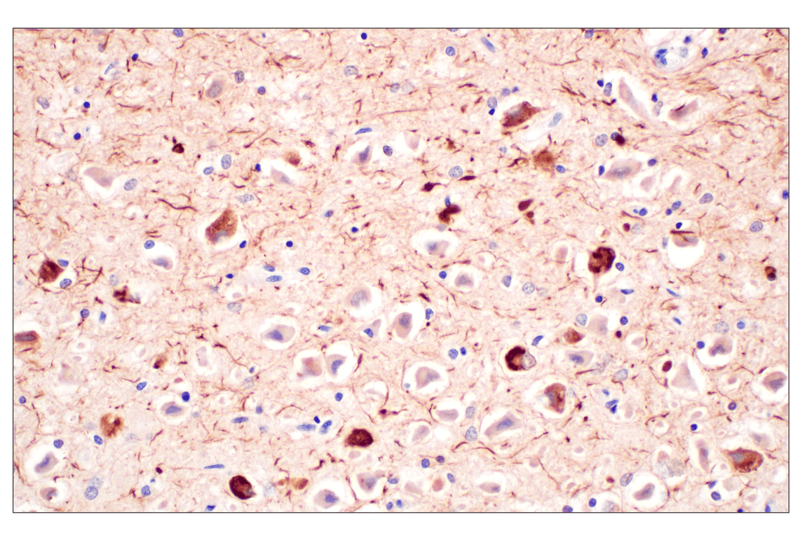 Immunohistochemistry Image 1: Phospho-Tau (Ser202) (F2A2F) Rabbit Monoclonal Antibody