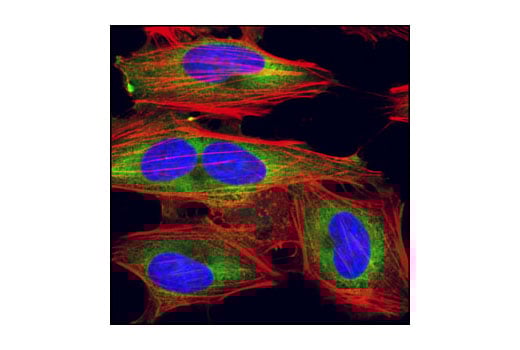 Immunofluorescence Image 1: eIF4GI Antibody