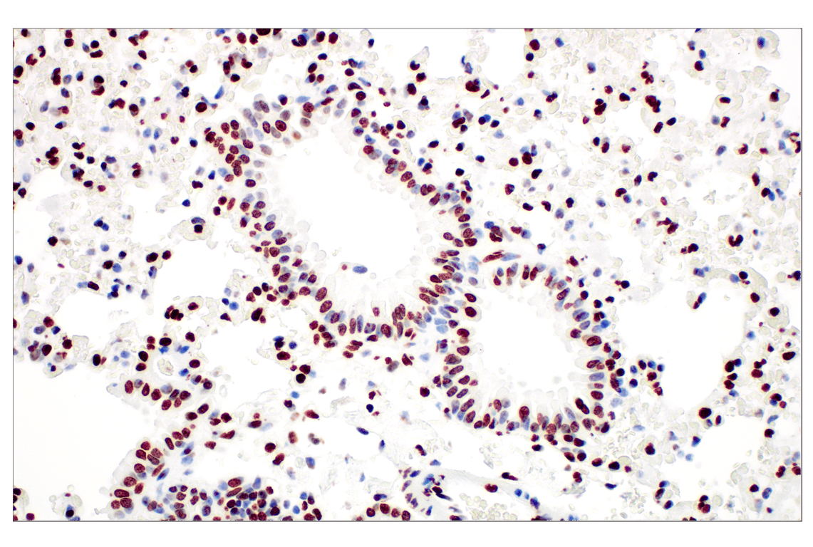 Immunohistochemistry Image 1: Tri-Methyl-Histone H3 (Lys27) (C36B11) Rabbit Monoclonal Antibody (BSA and Azide Free)