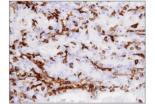 Immunohistochemistry Image 3: CD14 (D7A2T) Rabbit Monoclonal Antibody (IHC Formulated)