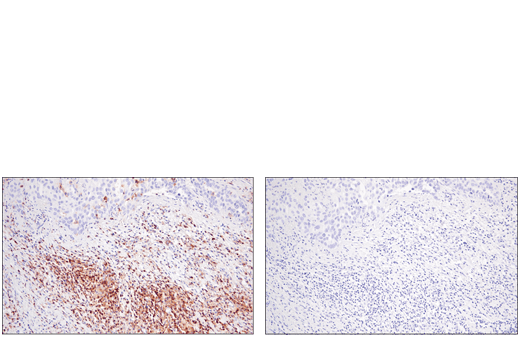 Immunohistochemistry Image 3: CD48 (D7L8I) Rabbit Monoclonal Antibody (BSA and Azide Free)