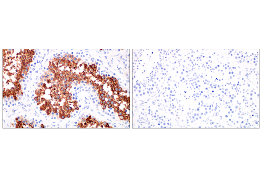 Immunohistochemistry Image 10: Glut3 (E7M7V) Rabbit Monoclonal Antibody
