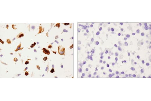 Immunohistochemistry Image 3: Annexin A1 (D5V2T) XP<sup>®</sup> Rabbit mAb (BSA and Azide Free)