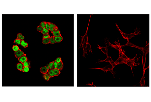 Immunofluorescence Image 1: c-Myc (E5Q6W) Rabbit Monoclonal Antibody (BSA and Azide Free)