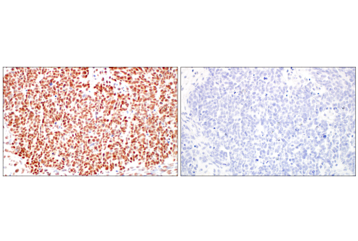 Immunohistochemistry Image 10: Rad50 (E4J5R) Rabbit Monoclonal Antibody