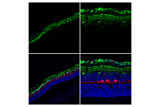 Immunofluorescence Image 1: Calretinin (E7R6O) Rabbit Monoclonal Antibody (BSA and Azide Free)