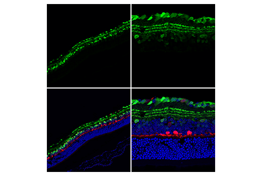 Immunofluorescence Image 1: Calretinin (E7R6O) XP<sup>®</sup> Rabbit mAb (BSA and Azide Free)