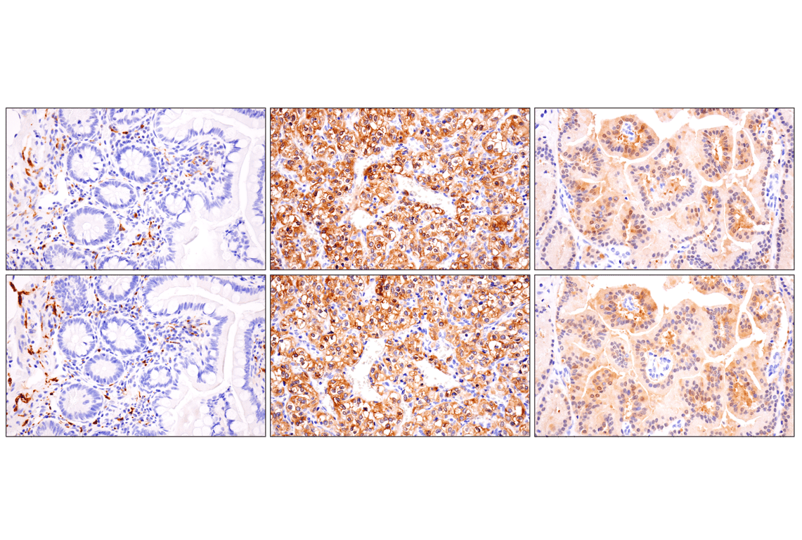 Immunohistochemistry Image 3: Phospho-Tau (Ser202) (F2A2F) Rabbit Monoclonal Antibody