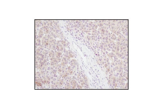 Immunohistochemistry Image 2: 4E-BP1 (53H11) Rabbit mAb