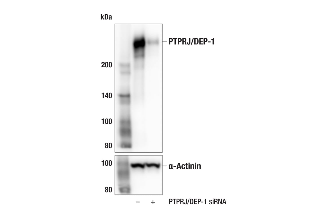 Western Blotting Image 2: PTPRJ/DEP-1 (F4G8K) Rabbit Monoclonal Antibody