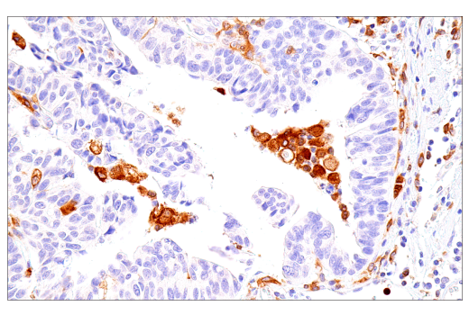 Immunohistochemistry Image 5: DAP12 (E8P9U) Rabbit Monoclonal Antibody (BSA and Azide Free)