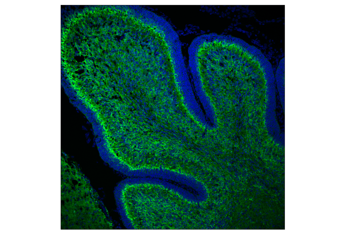 Immunofluorescence Image 1: Doublecortin (F6K9E) Rabbit Monoclonal Antibody