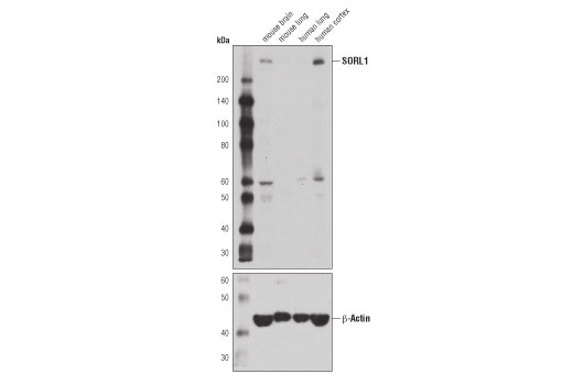 Western Blotting Image 1: SORL1 (D8D4G) Rabbit mAb