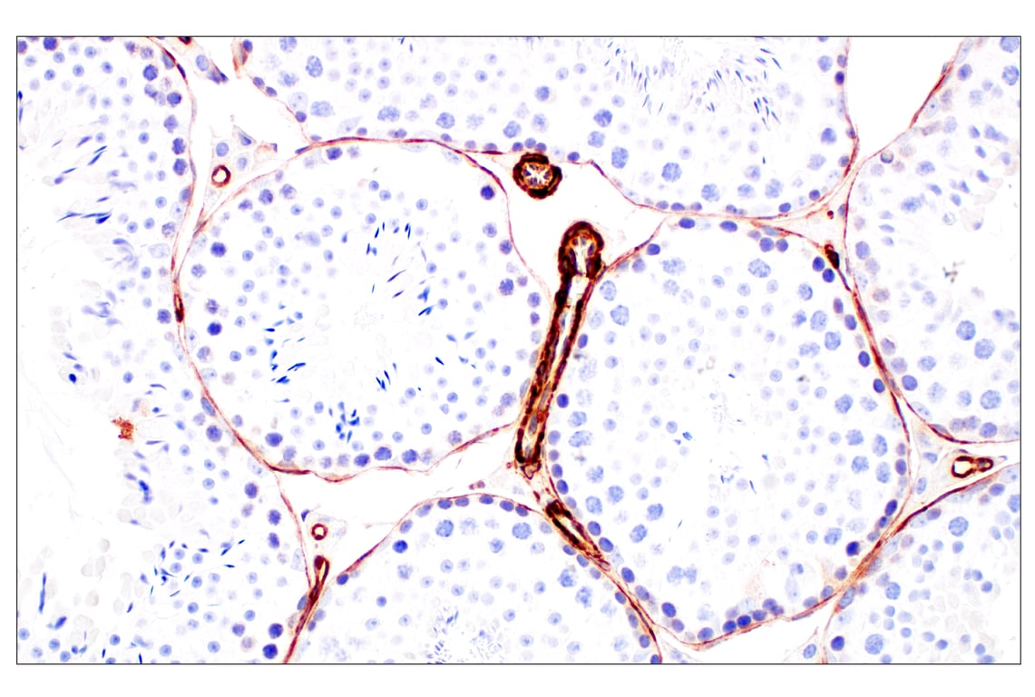 Immunohistochemistry Image 12: Filamin A (E8P8M) Rabbit Monoclonal Antibody