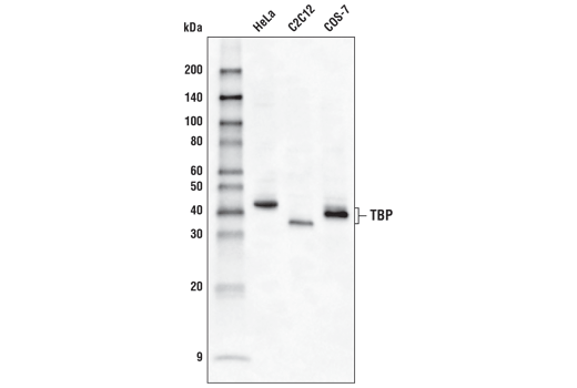 Western Blotting Image 1: TBP (D5C9H) XP<sup>®</sup> Rabbit mAb (HRP Conjugate)