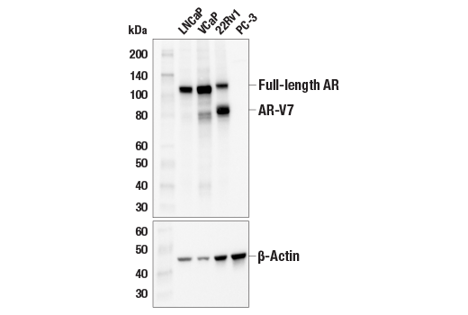 Western Blotting Image 2: Androgen Receptor (D6F11) Rabbit Monoclonal Antibody (Biotinylated)