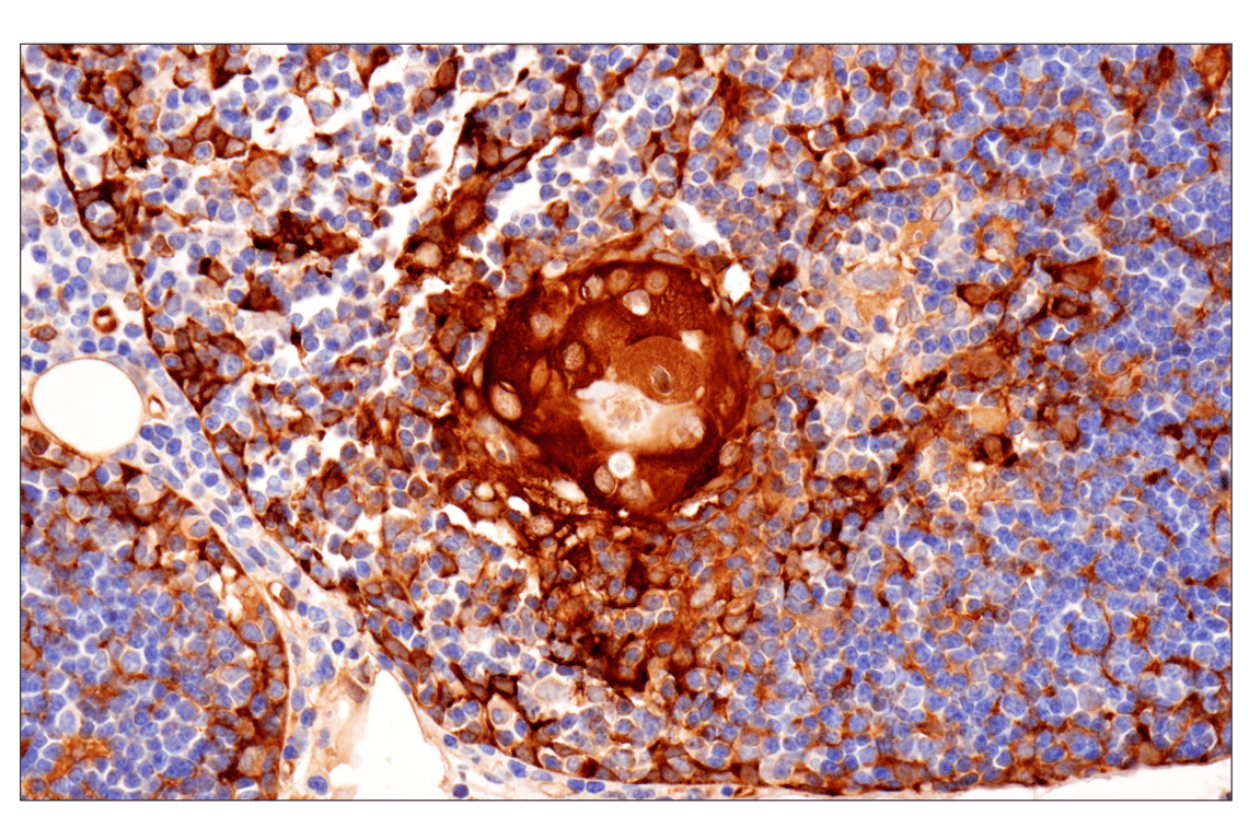 Immunohistochemistry Image 5: HSP27 (E1J4D) Rabbit Monoclonal Antibody