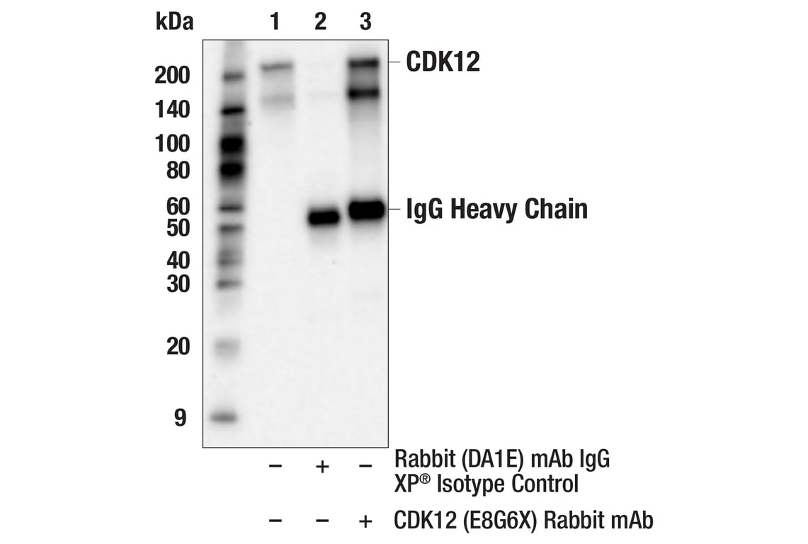 Immunoprecipitation Image 1: CDK12 (E8G6X) Rabbit Monoclonal Antibody
