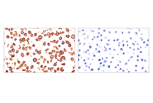 Immunohistochemistry Image 3: LAIR-1 (E7X6I) Rabbit Monoclonal Antibody