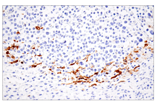 Immunohistochemistry Image 2: iNOS (E1W4J) Rabbit Monoclonal Antibody