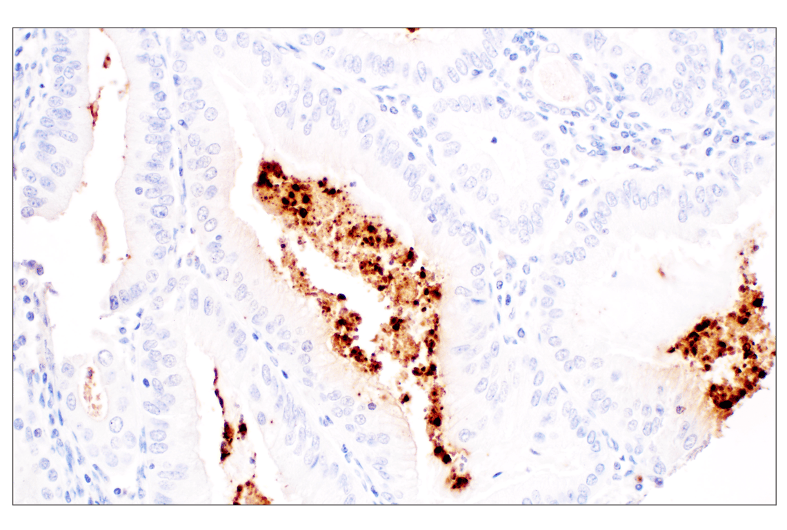 Immunohistochemistry Image 2: Citrullinated Histone H3 (Arg2) (F3C9B) Rabbit mAb (IHC Formulated)