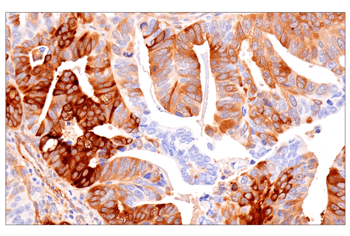 Immunohistochemistry Image 1: HSP27 (E1J4D) Rabbit Monoclonal Antibody