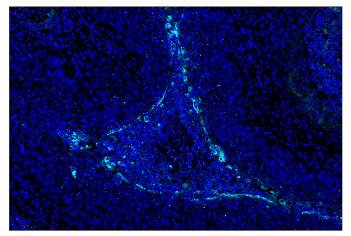 Immunohistochemistry Image 2: IL-8 (E5F5Q) & CO-0178-488 SignalStar<sup>®</sup> Oligo-Antibody Pair