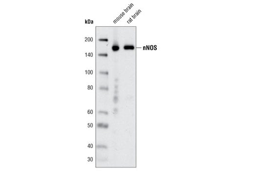 Western Blotting Image 1: nNOS (C12H1) Rabbit mAb