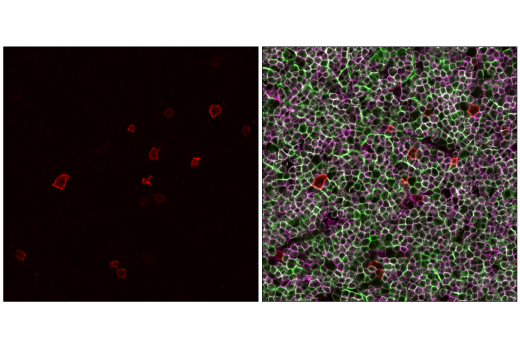 Immunofluorescence Image 1: IL-2Rα/CD25 (E9W2J) XP<sup>®</sup> Rabbit mAb (Alexa Fluor<sup>®</sup> 555 Conjugate)