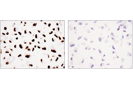 Immunohistochemistry Image 3: Tri-Methyl-Histone H3 (Lys36) (D5A7) Rabbit Monoclonal Antibody (BSA and Azide Free)