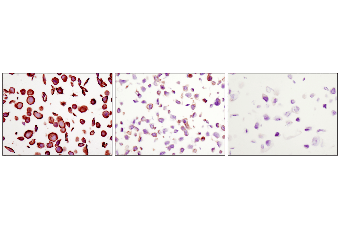 EGF Receptor (D38B1) XP® Rabbit mAb (#4267) Datasheet With Images ...