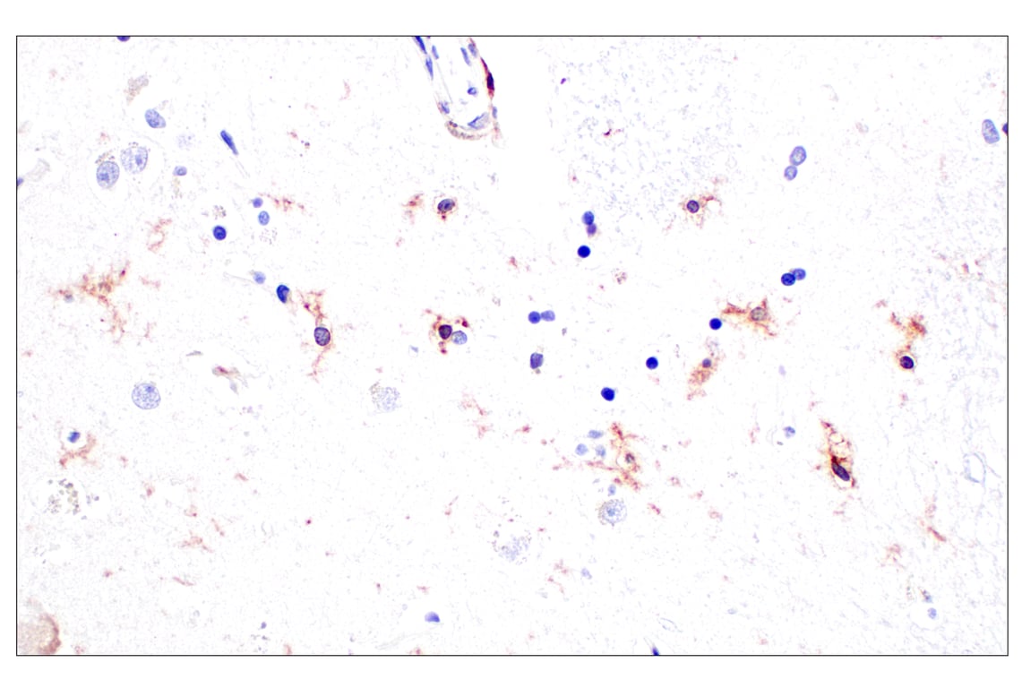 Immunohistochemistry Image 10: CD11b/ITGAM (E3J2F) Rabbit Monoclonal Antibody