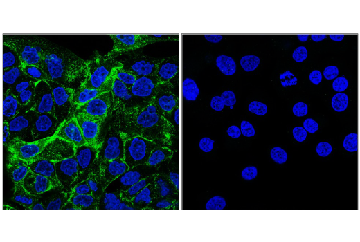 Immunofluorescence Image 1: PLVAP (E3X9D) Rabbit Monoclonal Antibody