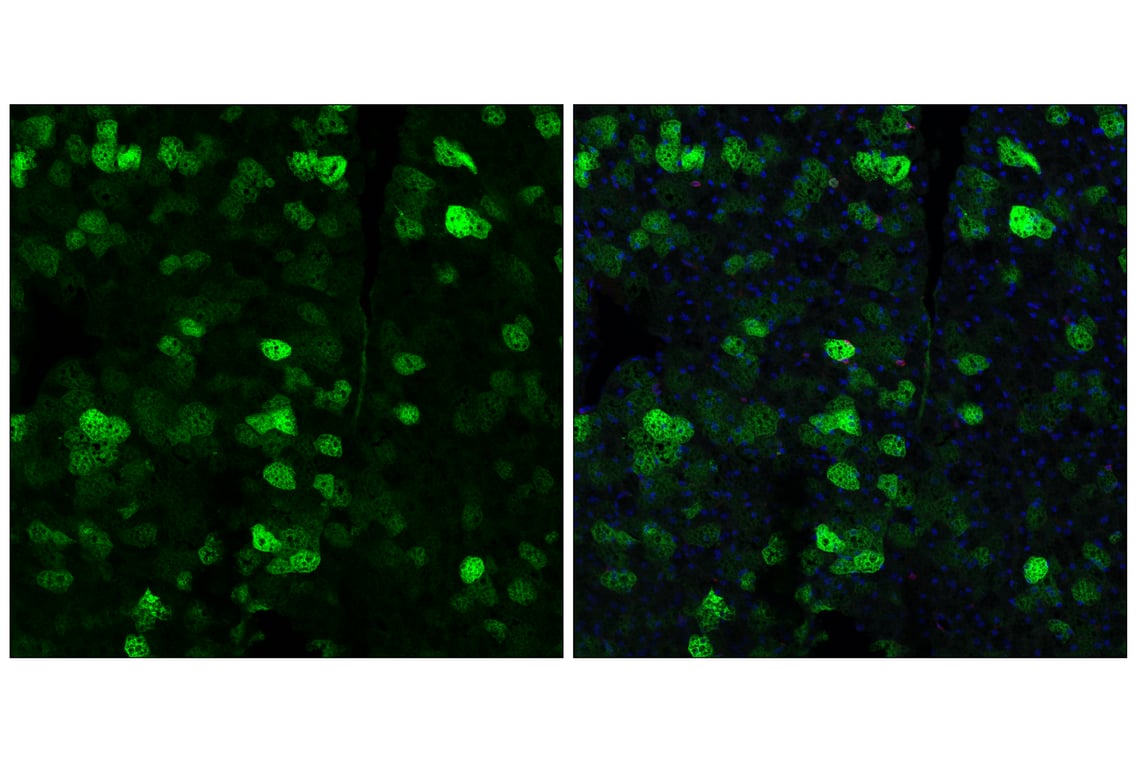 Immunofluorescence Image 3: SCD1 (C12H5) Rabbit Monoclonal Antibody (Alexa Fluor<sup>®</sup> 488 Conjugate)