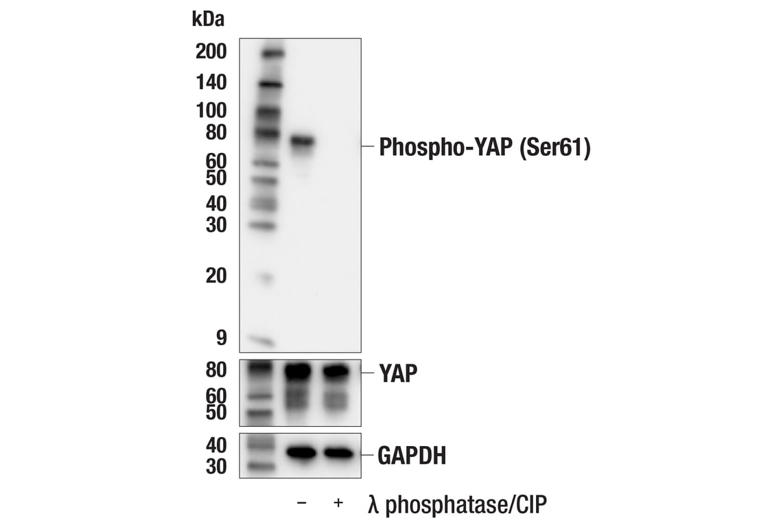 Western Blotting Image 2: Phospho-YAP (Ser61) (E4Q8S) Rabbit Monoclonal Antibody