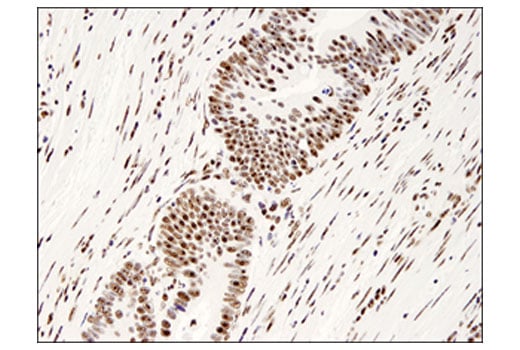 Immunohistochemistry Image 1: PELP1 (D5Q4W) Rabbit Monoclonal Antibody (BSA and Azide Free)