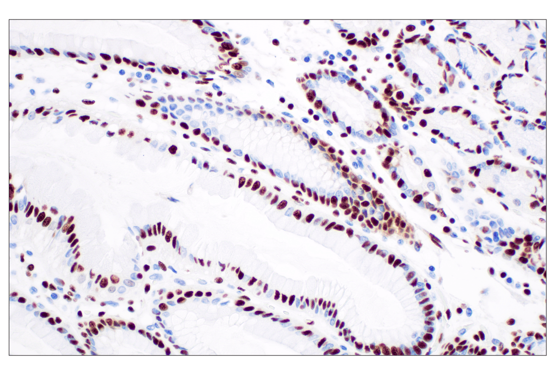 Immunohistochemistry Image 3: NPM1 (E7W4P) Rabbit Monoclonal Antibody (BSA and Azide Free)