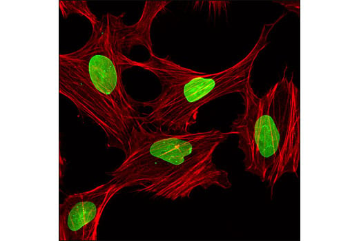 Immunofluorescence Image 1: Lamin A/C (4C11) Mouse mAb (Alexa Fluor<sup>®</sup> 488 Conjugate)