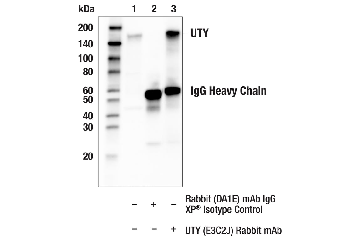 Immunoprecipitation Image 1: UTY (E3C2J) Rabbit Monoclonal Antibody
