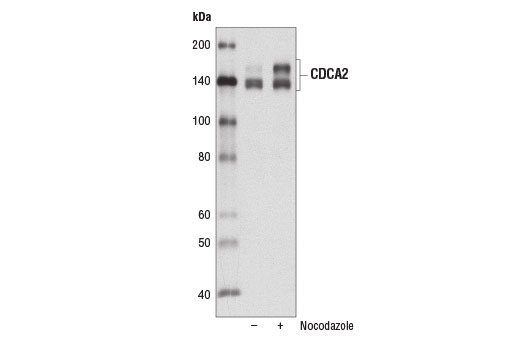 Western Blotting Image 2: CDCA2 (D7T4P) Rabbit Monoclonal Antibody