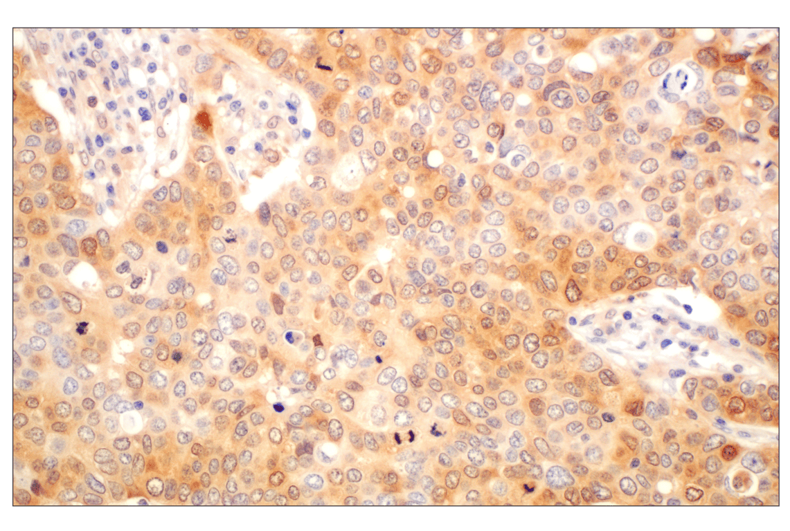 Immunohistochemistry Image 3: Galectin-8/LGALS8 (F9O3T) Rabbit Monoclonal Antibody
