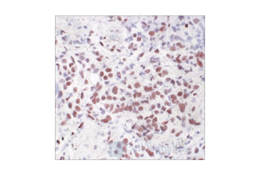 Immunohistochemistry Image 1: Phospho-ATF-2 (Thr71) Antibody
