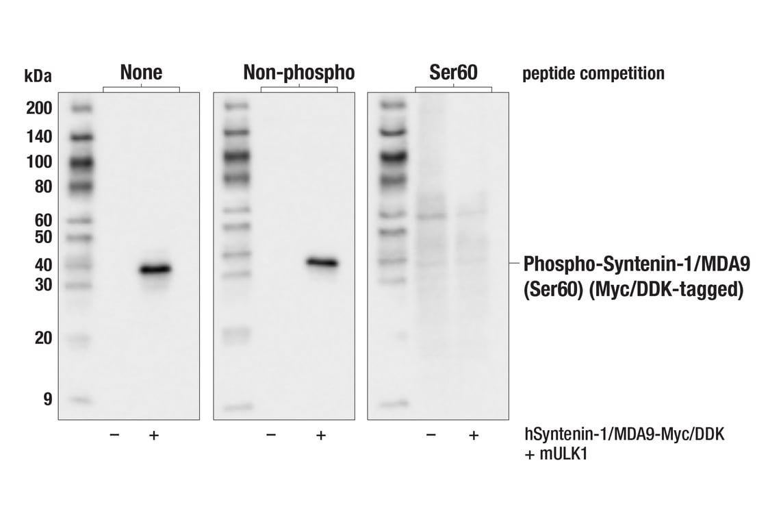 Western Blotting Image 2: Phospho-Syntenin-1/MDA9 (Ser60) (F4T2K) Rabbit Monoclonal Antibody