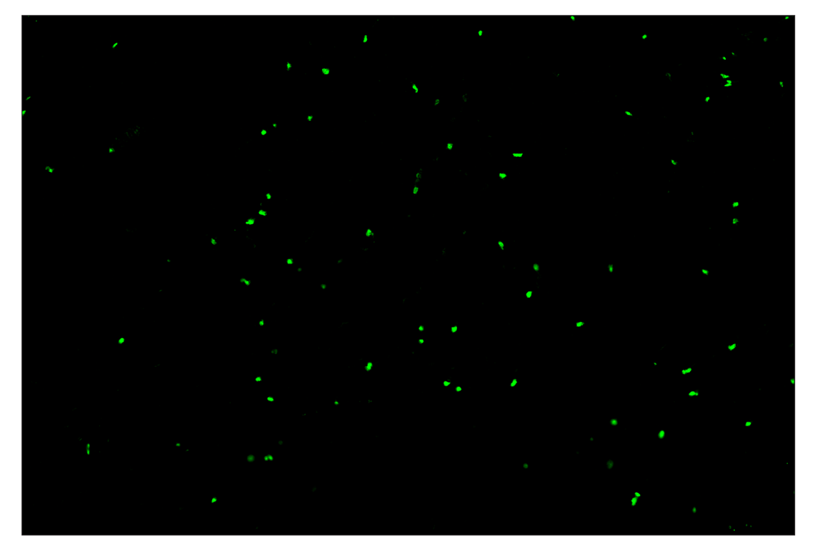 Immunohistochemistry Image 2: Sox10 (E6B6I) & CO-0080-647 SignalStar<sup>™</sup> Oligo-Antibody Pair