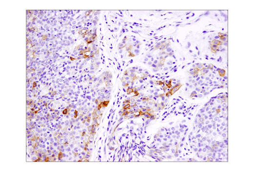 Immunohistochemistry Image 5: B7-H4 (D1M8I) Rabbit Monoclonal Antibody (BSA and Azide Free)