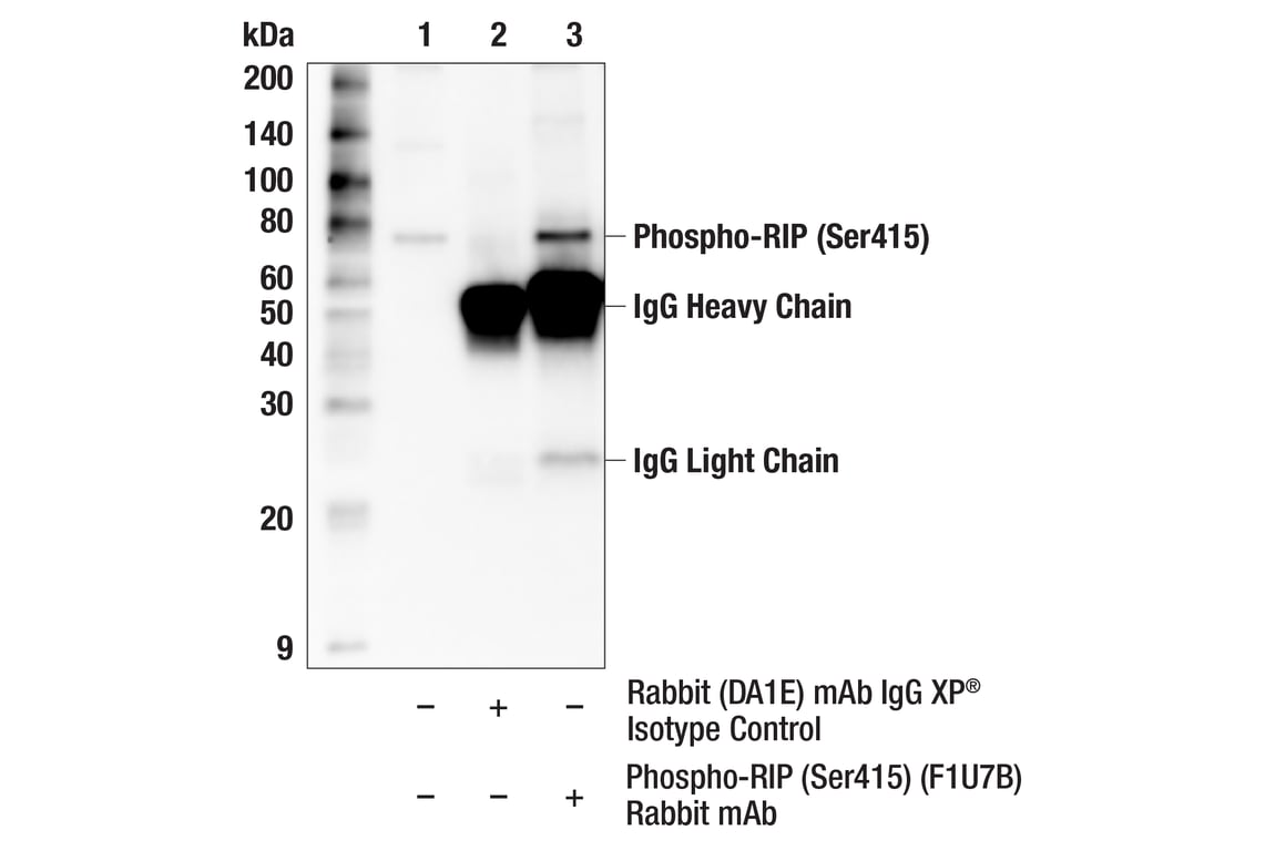 Immunoprecipitation Image 1: Phospho-RIP (Ser415) (F1U7B) Rabbit Monoclonal Antibody